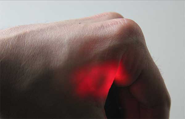 Implantes de biohacking: tecnologia além dos wearables